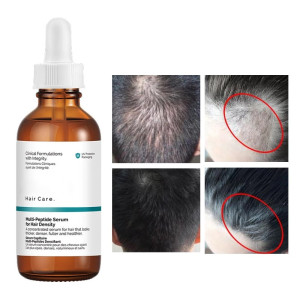 The Ordinary Multi-Peptide Hair Serum for Hair Density 30ml